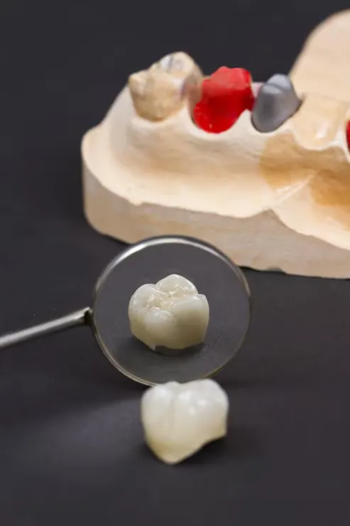 ceramic-crown-molar-teeth_798519-599