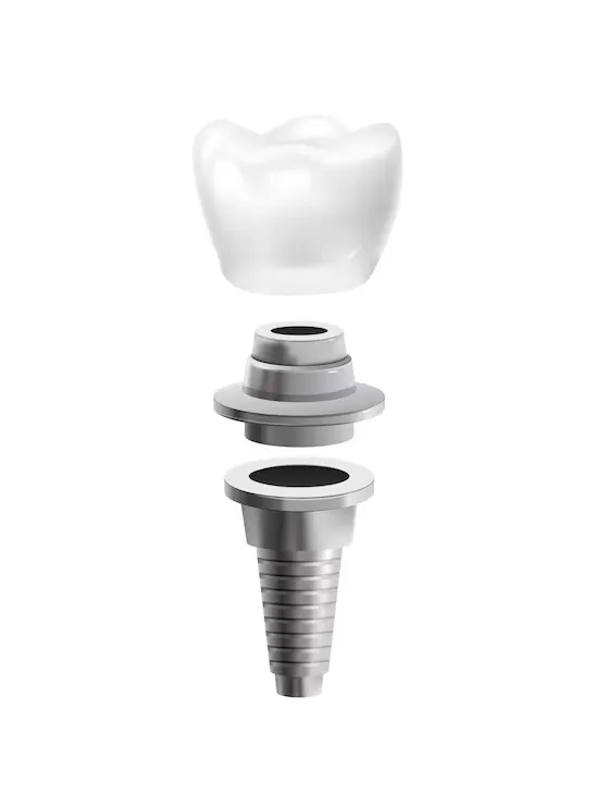 metal-dental-post-realistic-icon-isolated-vector-illustration_1284-66754