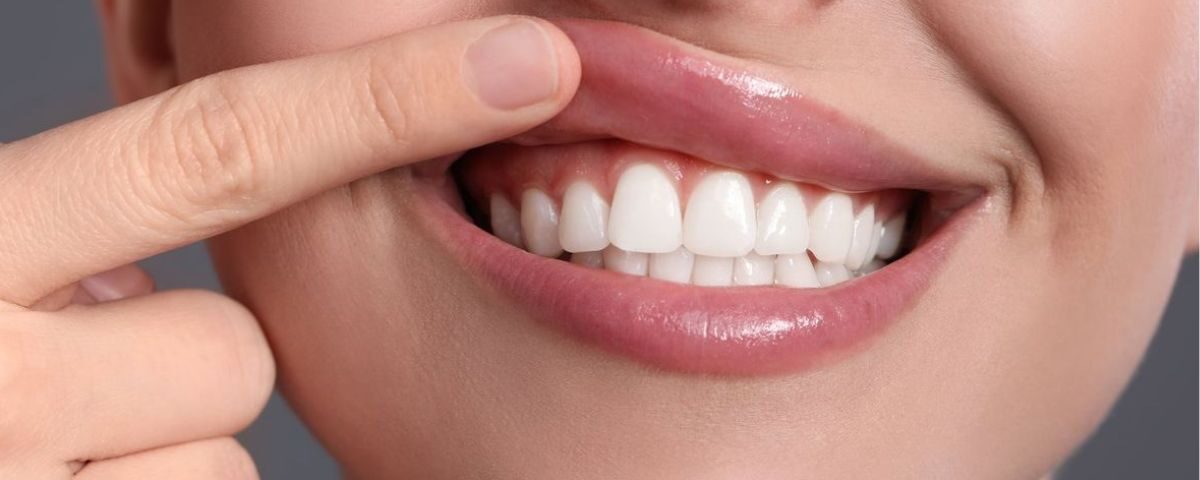 healthy teeth and gums